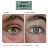(plated) EYE Serum