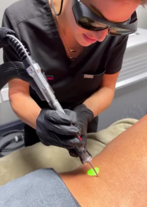 Virginia Beach Med Spa Featured Service Laser Hair Removal The