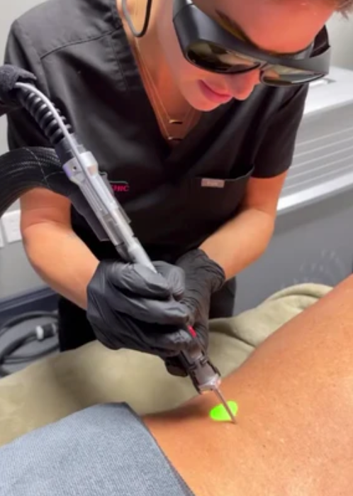 Med Spa Service Feature: Laser Hair Removal